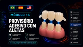 Provisório Adesivo com Aletas